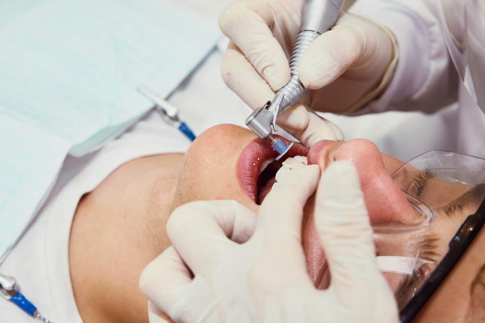 Ultimate Guide to Selling Dental Benefits for Small Businesses